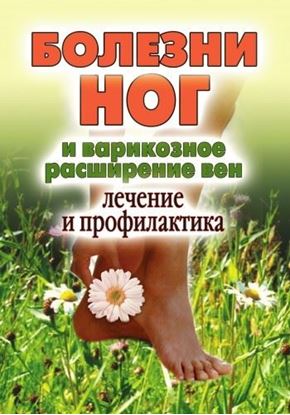 Обложка книги "Болезни ног и варикозное расширение вен. Лечение и профилактика"