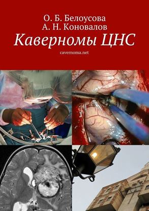 Обложка книги "Каверномы ЦНС"