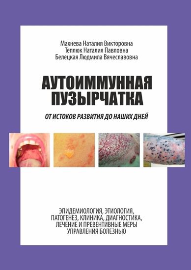 Обложка книги "Аутоиммунная пузырчатка. От истоков развития до наших дней"