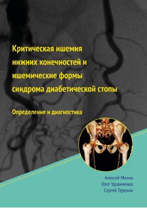 Обложка книги "Критическая ишемия нижних конечностей и ишемические формы синдрома диабетической стопы"